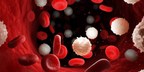 Alercell to Distribute Leukemia Fusion Gene Screening and Genotyping Kit