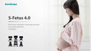 SonoScape lance le S-Fetus 4.0 pour simplifier le processus d'échographie