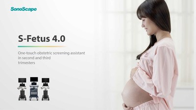 Assistente de exame obstétrico S-Fetus 4.0 da SonoScape (PRNewsfoto/SonoScape Medical Corporation)