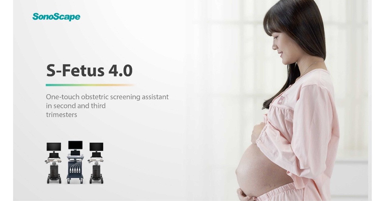 Lan&ccedil;amento do S-Fetus 4.0 da SonoScape simplificar&aacute; o processo de ultrassonografia