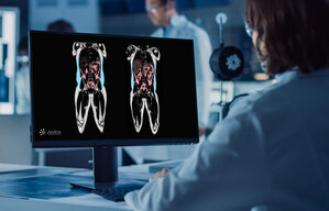 AMRA Medical's MRI-based body composition measurements used in Lilly's SURPASS-3 tirzepatide sub-study