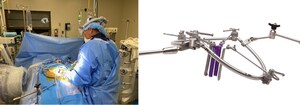 TeDan Surgical Innovations Reimagines Anterior to the Psoas Access with the Release of the Phantom UL ZeroATP® Surgical Access System