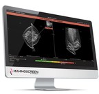 Therapixel gibt den Abschluss einer Serie-B-Finanzierung in Höhe von 15 Mio. EUR für den Einsatz von MammoScreen® 2D/3D bekannt