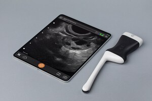 Clarius and Turtle Health Partner on Patient-Enabled Gynecology Solution with Study Showing Effectiveness of At-Home Ultrasound Follicle Counting