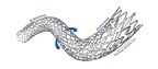 Stents With Torsional Strength for Superficial Femoral Artery...