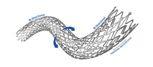 Stents With Torsional Strength for Superficial Femoral Artery Disease: The Prospective Q3-Registry