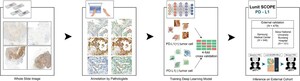 Lunit AI Biomarker PD-L1 Demonstrates Clinical Efficacy as Diagnostic Aid in Cancer Treatment-Published in the European Journal of Cancer