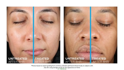 ROCHE-POSAY EXPANDS DOUBLE REPAIR MOISTURIZER LINE WITH NEW OFFERING FOR OILY SKIN
