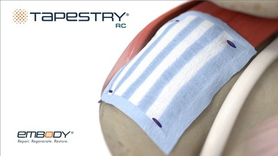 TAPESTRY RC Biointegrative Implant System