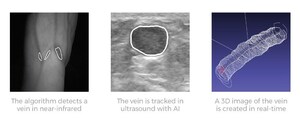 Vitestro unveils autonomous blood drawing device, combining artificial intelligence, ultrasound imaging and robotics