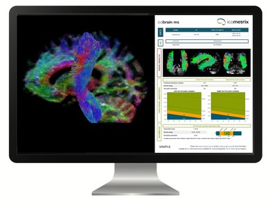 icobrain ms report