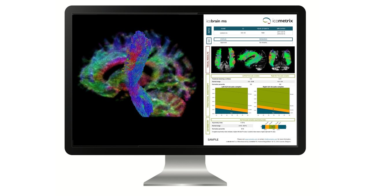 icometrix kondigt DocPanel aan om de icobrain-portfolio te introduceren