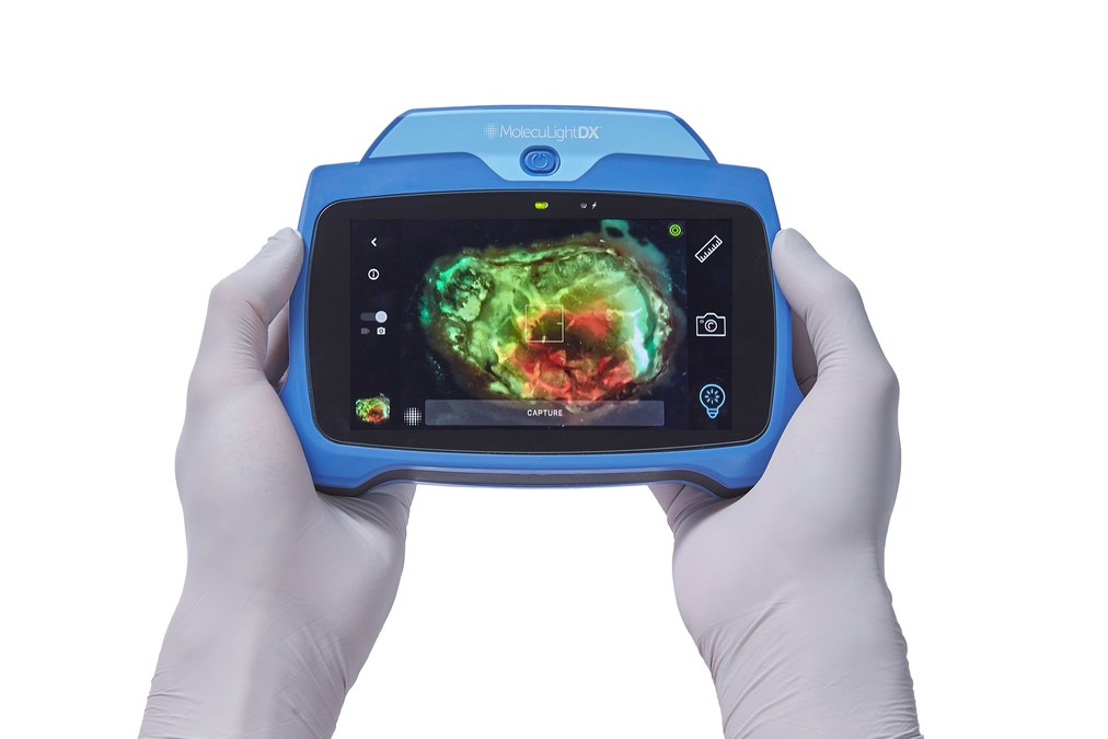 MolecuLight Awarded Point-of-Care Wound Imaging Devices Agreement with Premier, Inc. - Vimarsana News