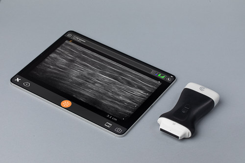 The Clarius L7 HD3 wireless ultrasound is considered the leading choice for plastic surgeons due to its affordability, ease of use, and high-resolution imaging powered by artificial intelligence. Sales of Clarius ultrasound to plastic surgeons are soaring following the Florida Board of Medicine's recent approval of an emergency order mandating the use of ultrasound during BBL surgeries to avoid injecting fat into the muscle and reduce the risk of fat embolisms.