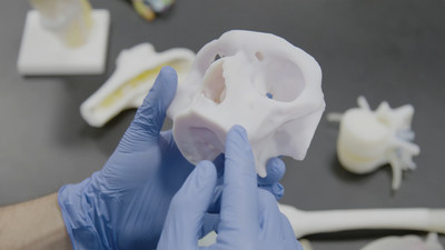 3D-printed anatomic model