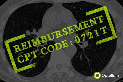 Effective July 1, 2022, hospitals that bill CMS for Optellum Lung Cancer Prediction for their Medicare patients will be eligible for reimbursement at a rate of $600-$700 under temporary CPT code 0721T to describe quantitative CT tissue characterization performed separate to a computed tomography (CT) scan.