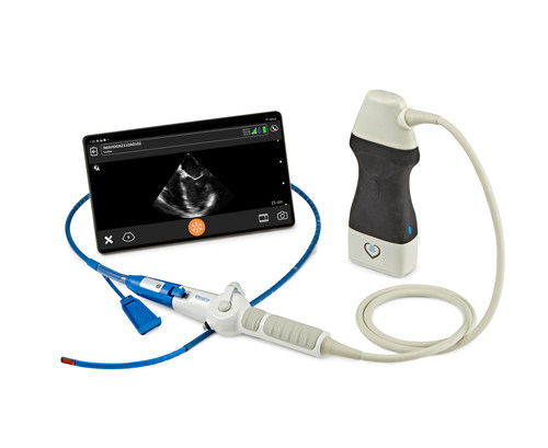 The Zura Handheld Hemodynamic UltrasoundTM system powered by Clarius provides an instant, clear window to directly visualize preload and contractility over time. It has received clearance by the U.S. Food and Drug Administration to help clinicians make the right decisions, at the right time.