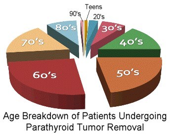 This pie chart is from 24,000 patients with hyperparathyroidism who were operated on at the Norman Parathyroid Center. It is easy to see that most parathyroid patients are between 45 and 90.