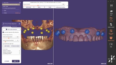 exoplan 3.0 Galway enables two CT or CBCT scans to be aligned with the dual-scan protocol to enable safe planning of edentulous cases and surgical guide design.