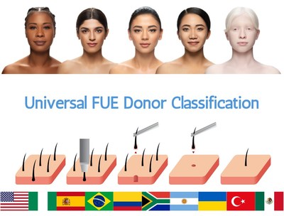 New universal FUE classification system - The Sanusi FUE Scoring (SFS) Scale reflects diversity in human hair and skin traits