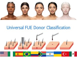A New FUE Classification System for Predicting Challenges in Hair Transplantation Reflects Human Evolutionary Trends