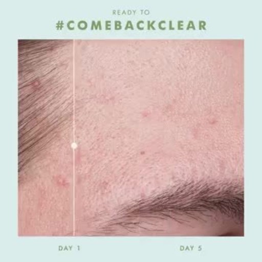 5 DAYS TO 'COMEBACK CLEAR™' FROM ACNE FARM-GROWN, ACNE-BUSTING COLLECTION FROM FARMHOUSE FRESH® BRINGS SPEEDY RELIEF