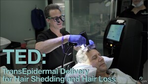 IN THE THICK OF HAIR LOSS AWARENESS MONTH TOP HAIR DOCTOR INTRODUCES ALMA TED: NEW BREAKTHROUGH NON-INVASIVE TECHNOLOGY TO IMPROVE HAIR GROWTH