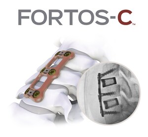 Centinel Spine® Expands Its Comprehensive Cervical Solutions Portfolio With Full Commercial Launch of FORTOS-C™ Anterior Cervical Plating System