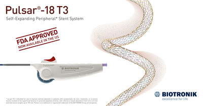 BIOTRONIK's new self-expanding peripheral stent system has received FDA Approval.