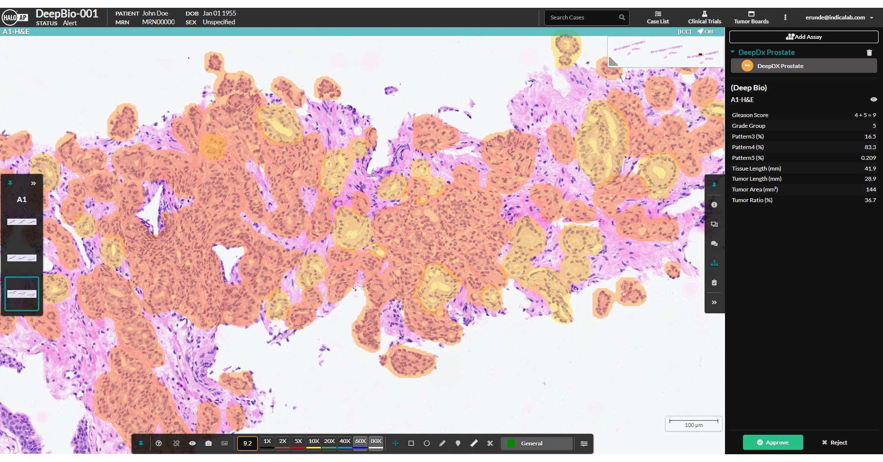 Deep Bio successfully integrates DeepDx® Prostate algorithm into HALO AP® platform from Indica Labs