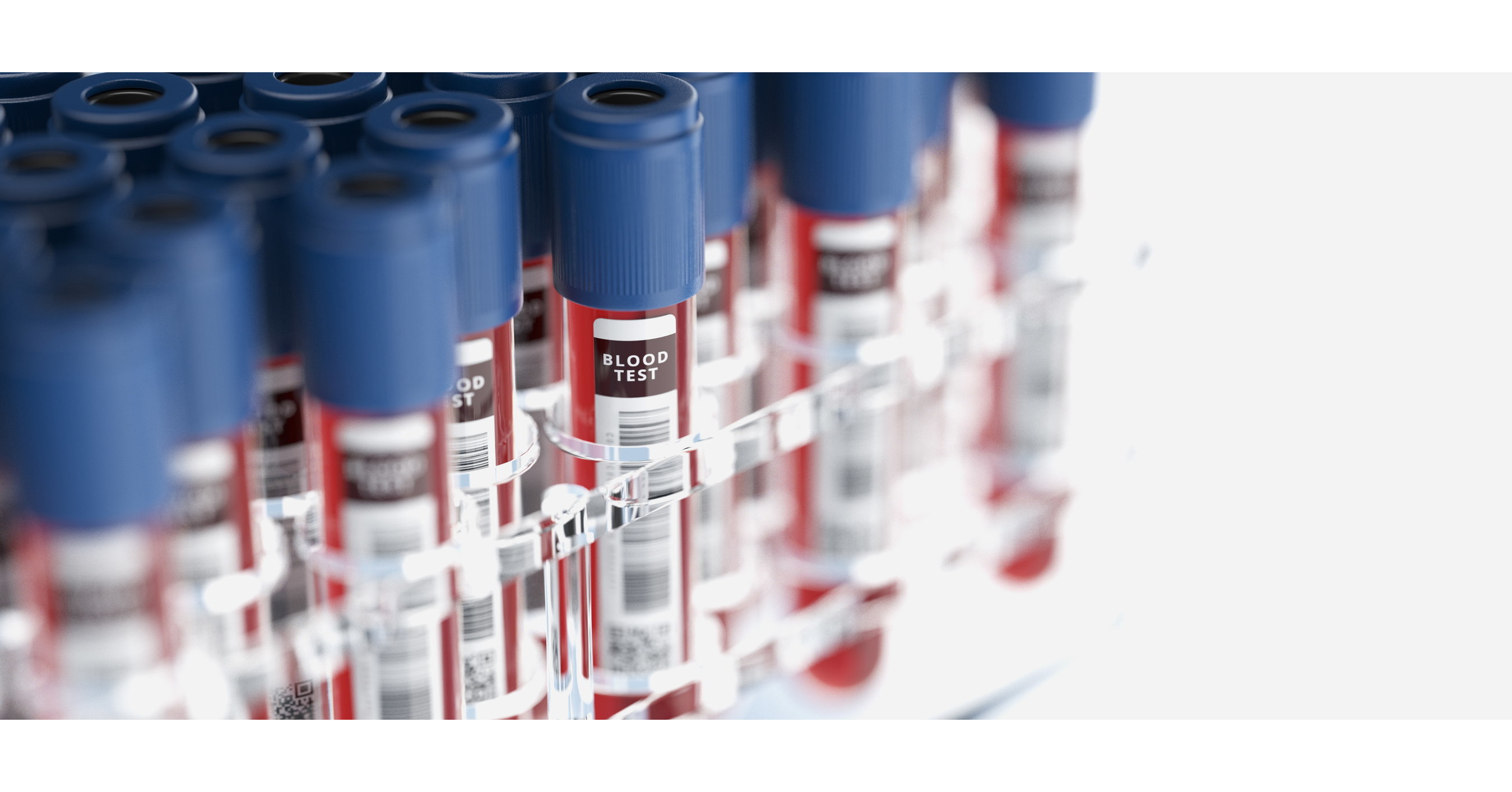 NuraLogix researchers announce AI models that can predict Metabolic Risks NuraLogix researchers announce AI models that can predict Metabolic Risks