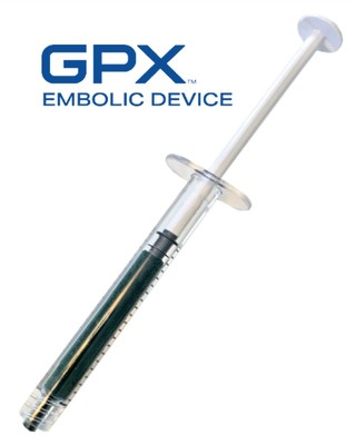 GPX Embolic Device (Photo: Fluidx Medical Technology)