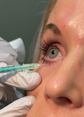 Eyelid Injection