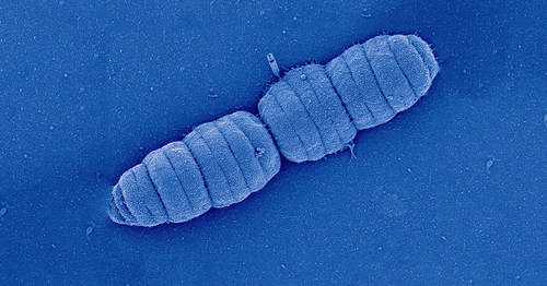 Scanning electron microscopy image of caterpillar-like bacterium Simonsiella muelleri ( family Neisseriaceae)Crédit : Sammy Nyongesa and Prof. Frédéric Veyrier (INRS). (CNW Group/Institut National de la recherche scientifique (INRS))