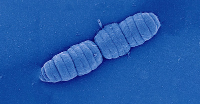 Image de microscopie électronique à balayage de la bactérie Simonsiella muelleri (de la famille des Neisseriaceae) ressemblant à une chenille.
Crédit : Sammy Nyongesa and Prof. Frédéric Veyrier (INRS). (Groupe CNW/Institut National de la recherche scientifique (INRS))