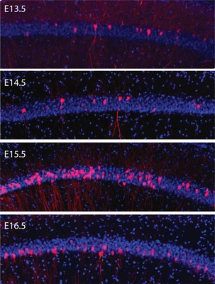 The image shows groups of brain cells that are born together on the same days (pink) and on different days (blue) in the hippocampus of a mouse embryo. Many more neurons are born on embryonic day 15.5 than on earlier or later days. The study found that cells with the same birthdates form circuits that work together to encode similar memories for life.

Courtesy of Roman Huszár et. al, Nature Neuroscience