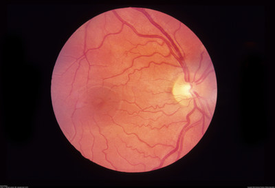 The Retina -  Located in the back of the eye, it converts light images into the nerve signals that become our view of the world.  Like the rest of the eye - beautiful, delicate, precious, and deserving of every protection. (PRNewsfoto/Safe Eyes America)