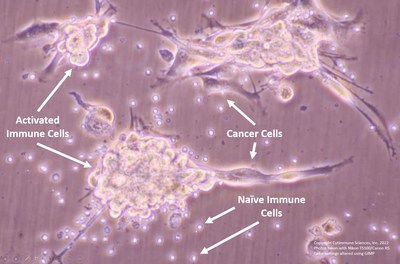 After treatment with Cytimmune's dual cytokine immunotherapy, CYT-IFNg-TNFa (a gold nanoparticle carrying interferon gamma and tumor necrosis factor alpha), cancer cells that normally would evade immune detection are recognized and attacked by immune cells. These "naïve" immune cells had not previously been exposed to the cancer cells. This suggest that CYT-IFNg-TNFa may activate a potent anti-cancer immune response. After treatment with Cytimmune's dual cytokine immunotherapy, CYT-IFNg-TNFa (a gold nanoparticle carrying interferon gamma and tumor necrosis factor alpha), cancer cells that normally would evade immune detection are recognized and attacked by immune cells. These "naïve" immune cells had not previously been exposed to the cancer cells. This suggest that CYT-IFNg-TNFa may activate a potent anti-cancer immune response.