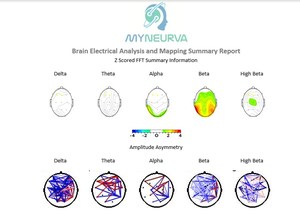 Myneurva launches StarrbaseTM to revolutionize the field of Remote Mental Health.