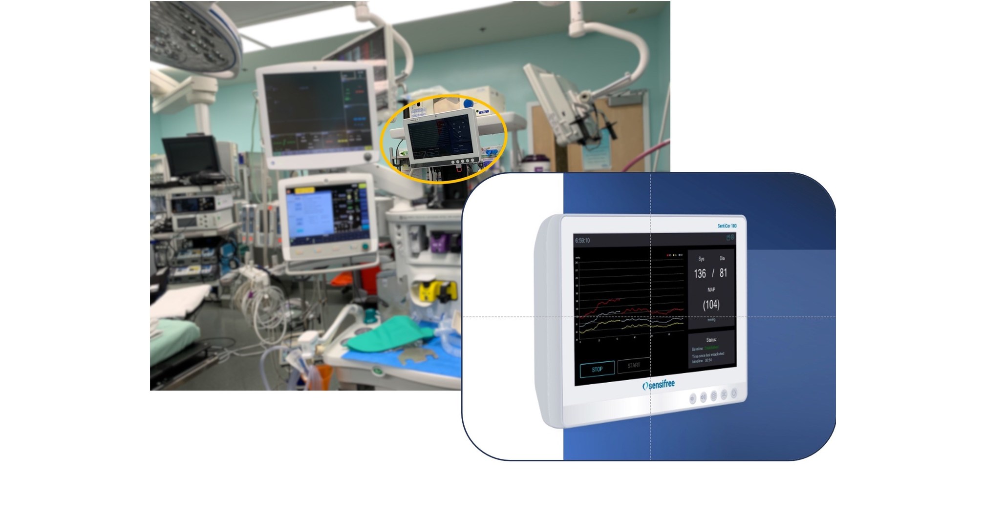 Mdr Standard CE & FDA Approved Digital Blood Pressure Monitor