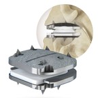 Centinel Spine® Announces First Commercial Use of prodisc® Cervical Total Disc Replacement Portfolio that Allows the Disc to be Matched to Patient Anatomy