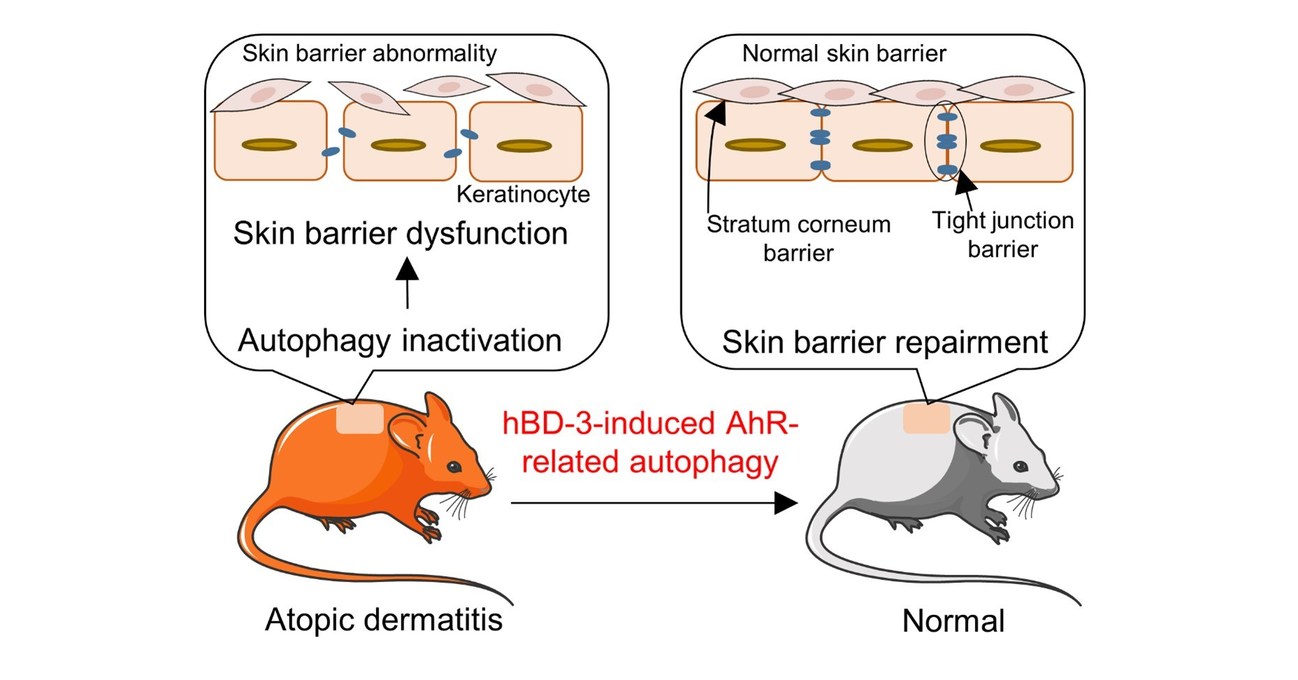 Juntendo University research: Itchy business: Investigating a cure for eczema