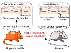 Juntendo University research: Itchy business: Investigating a cure for eczema