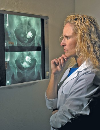 Physical therapist Belinda Wurn views x-rays of fallopian tube she opened for an infertility patients using only her hands