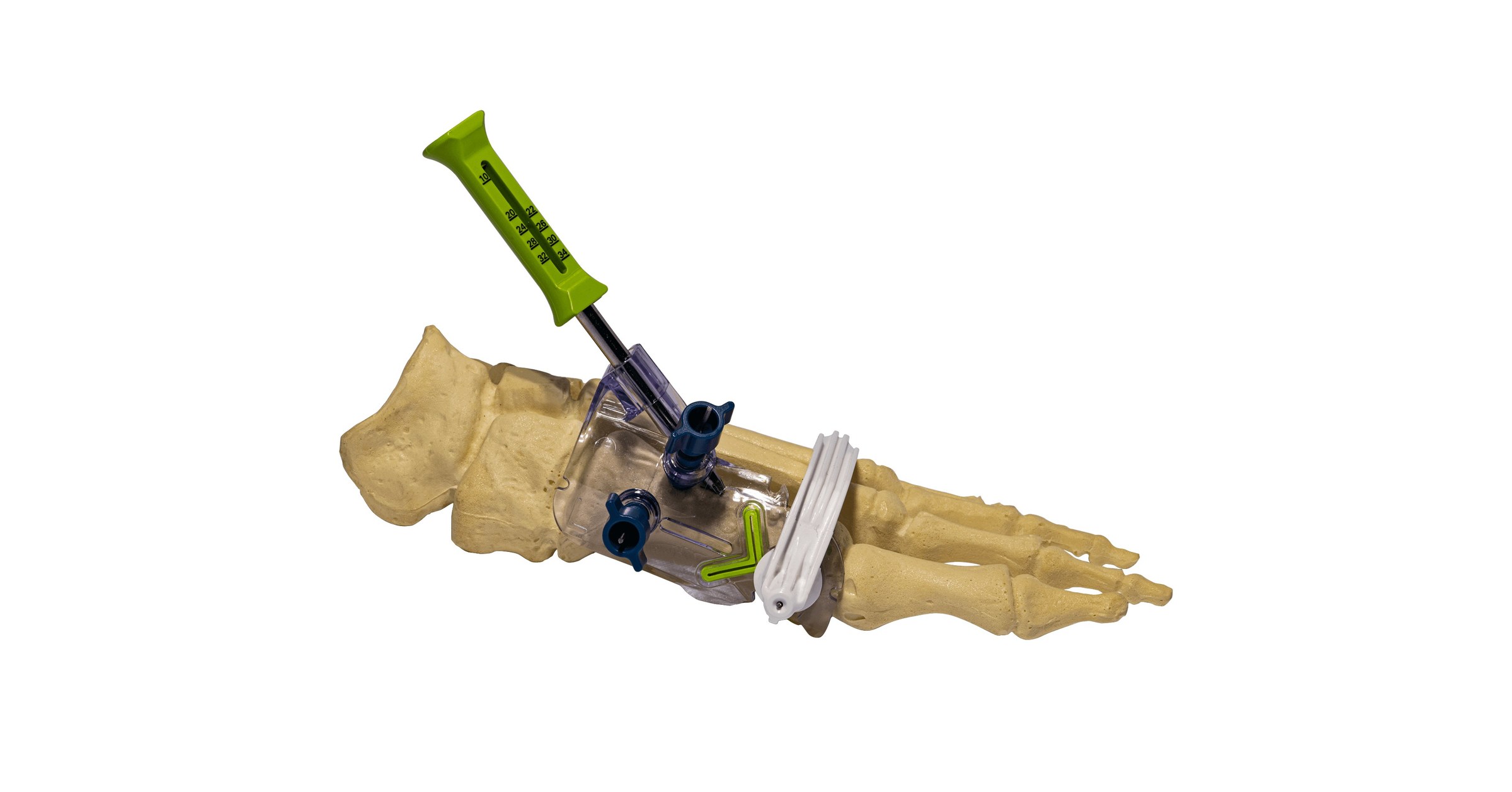 RELJA Innovations LLC Launches the MIS Precision Chevron Bunion System RELJA Innovations LLC Launches the MIS Precision Chevron Bunion System