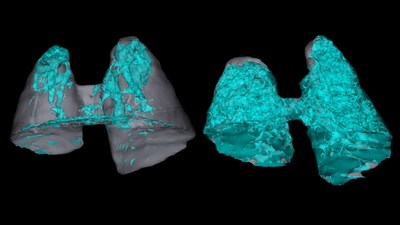 CSHL researchers have found treating mice with a drug candidate that inhibits a protein called PTP1B can prevent deadly lung inflammation in mice. Seen here are 3D images of mouse lungs treated with (left) and without (right) the PTP1B inhibitor drug candidate. The drug candidate prevented a lethal amount of lung damage, shown in cyan, from overactive immune cells called neutrophils. Image credit: Tonks lab/CSHL, 2022