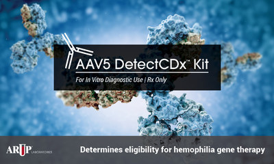 AAV5 DetectCDx™ Kit Is First ARUP Laboratories Test Developed to Support a New Therapy