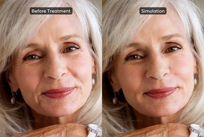 BeautyFix Medspa Launches The FIRST Ever Medically Accurate Aesthetics Simulation (PRNewsfoto/BeautyFix Medspa)