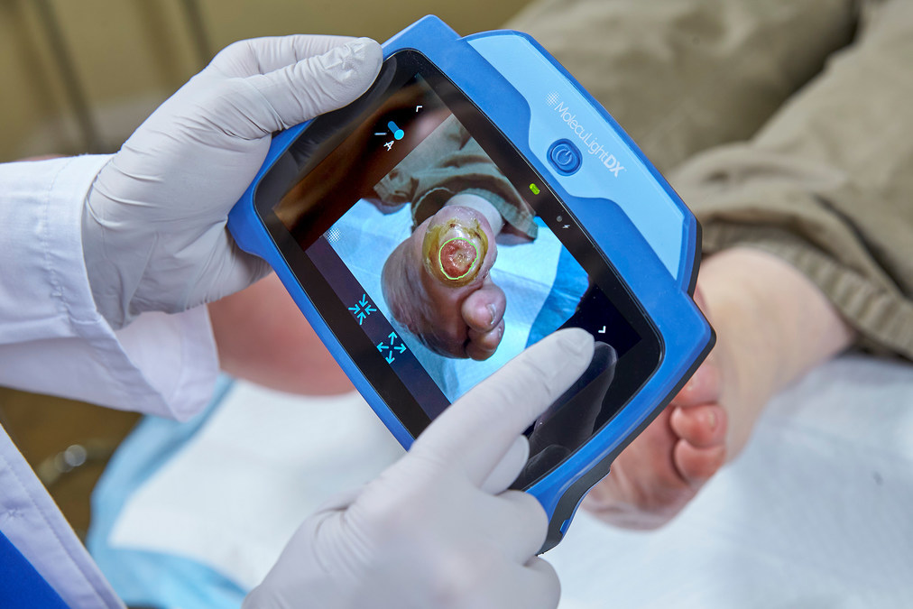 MolecuLight Point-of-Care Wound Imaging Devices Awarded Group Purchasing Agreement with AllSpire Health GPO - Vimarsana News