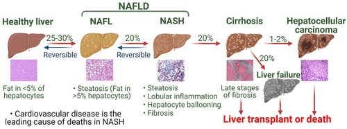 New Chinese Medical Journal article explores the importance of HNF4α, a hormone receptor, in the pathogenesis of non-alcoholic fatty liver disease (NAFLD)